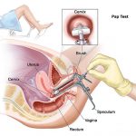 Pap Smear