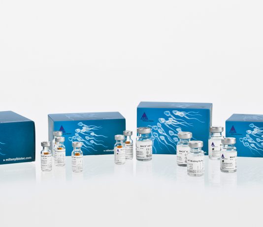 Chọn lọc tinh trùng không phân mảnh ADN