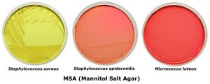 Mannitol Salt Phenol Red Agar