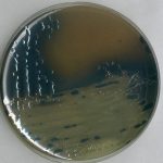 105418_Bismuth-Sulfit-Agar_Salmonella