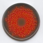 Moi-truong-thach-Hektoen-enteric-agar