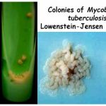 moi-truong-Lowenstein-Jensen-medium