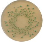 Hoa-chat-116122-Chromocult-TBX-Agar
