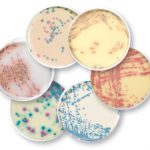 Moi-truong-mau-nuoi-cay-vi-khuan