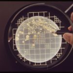 phuong-phap-dem-khuan-lac-vi-khuan